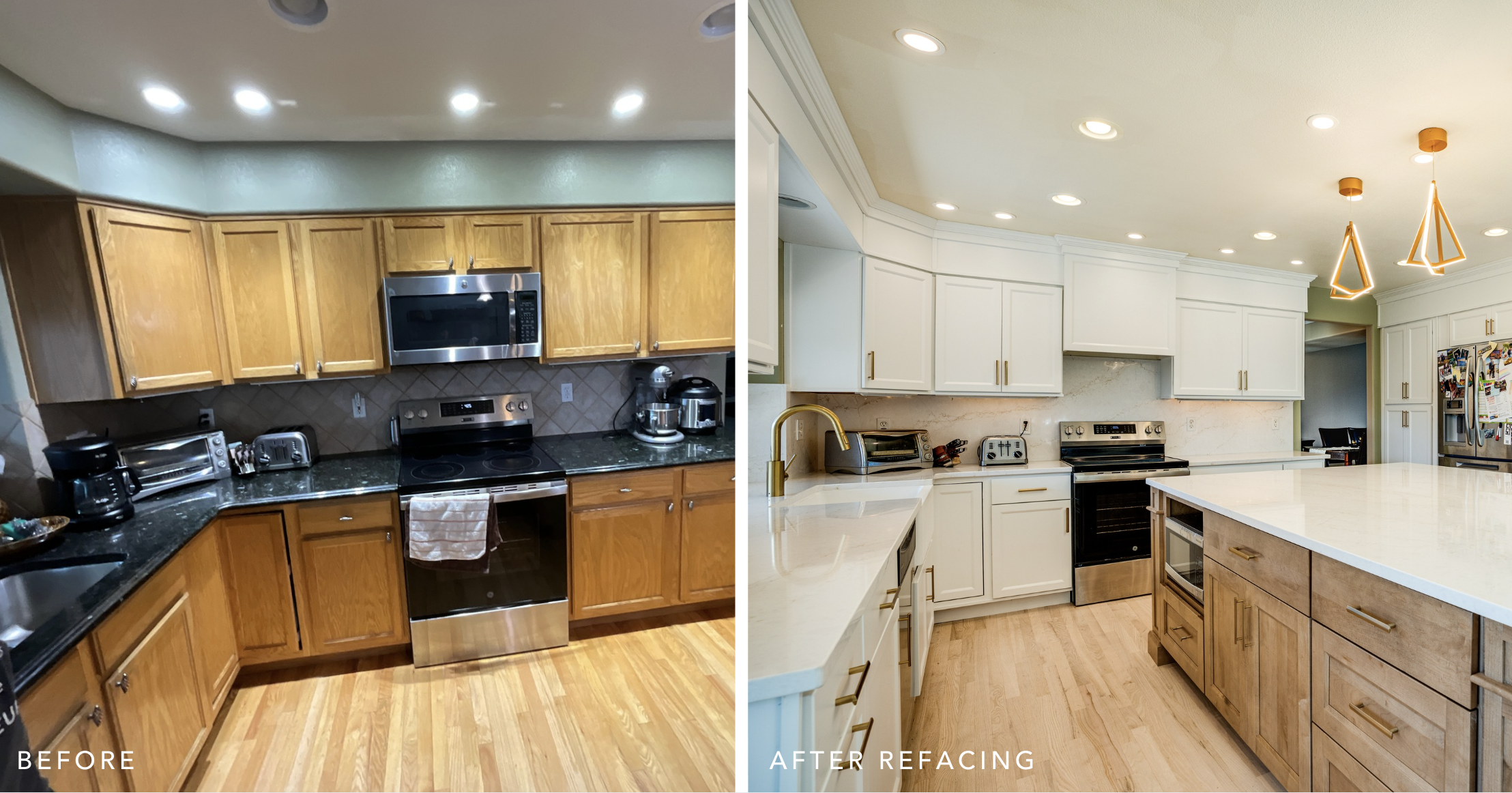 Refacing Before After