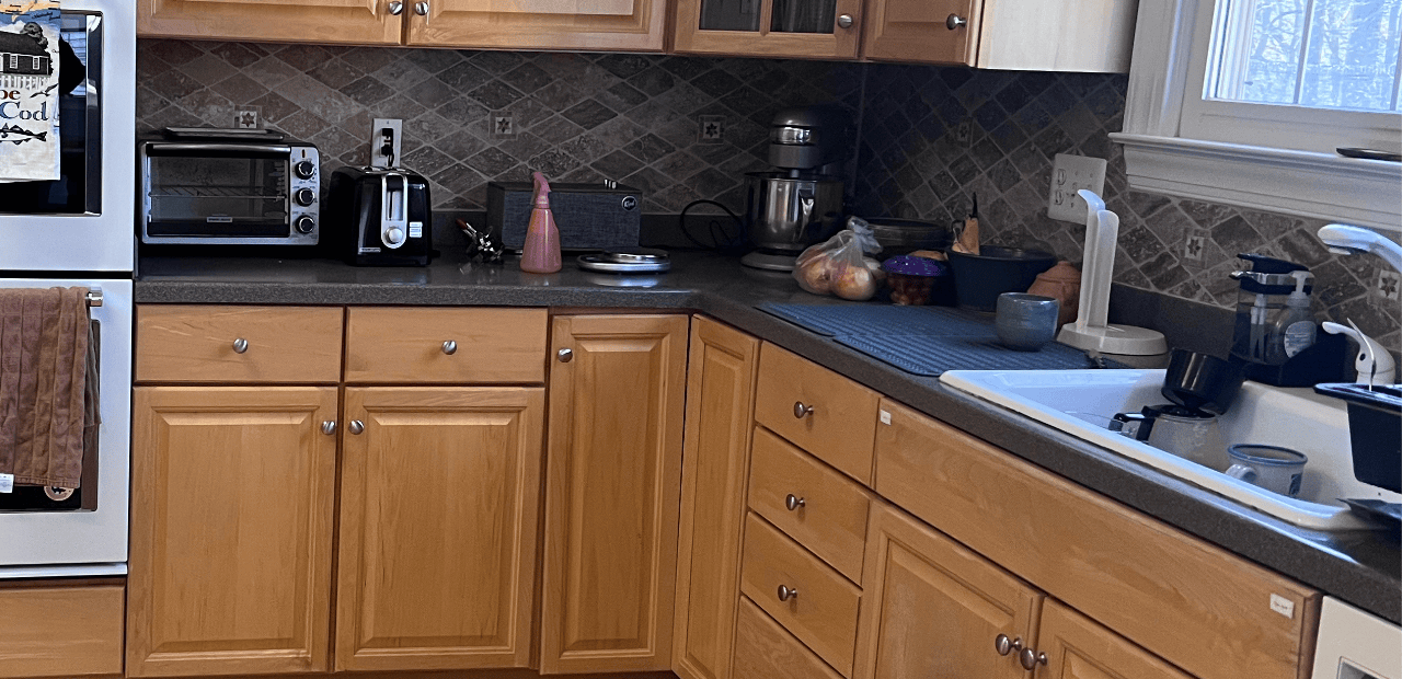 Olney, MD Refacing+ Before